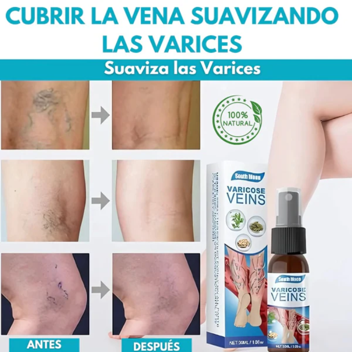 Adiós Venas Spray con envío gratis
