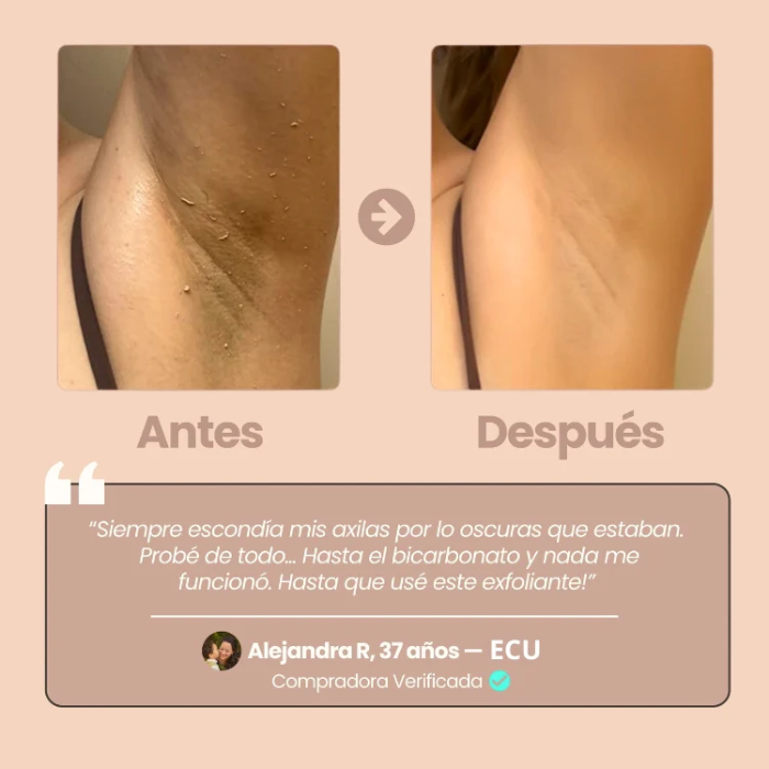 Quarxery Gel - Exfoliante Aclarador.