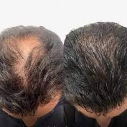 Aceite de Batana para el crecimiento del cabello 100% natural